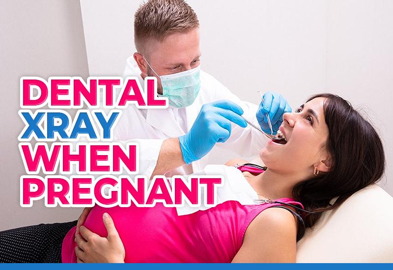 DENTAL X-RAYED WHEN PREGNANT