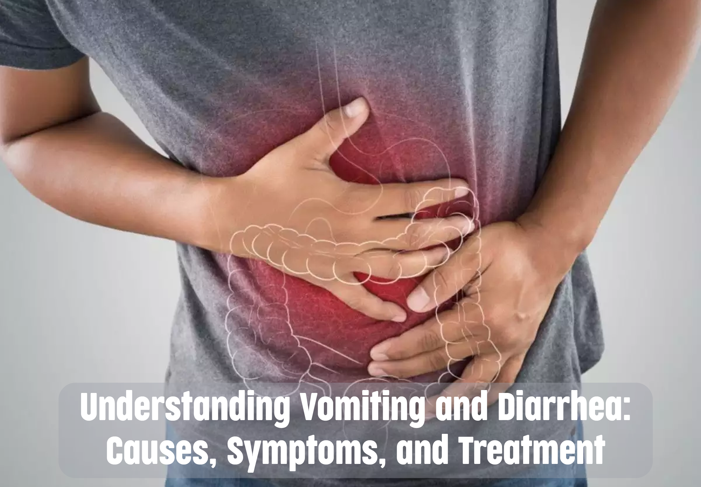 Understanding Vomiting and Diarrhea Causes, Symptoms, and Treatment