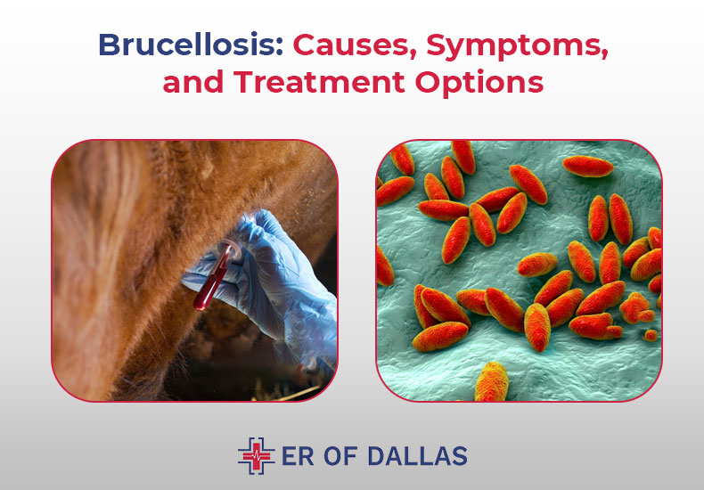 Brucellosis - Causes, Symptoms and Treatment Options - ER of Dallas