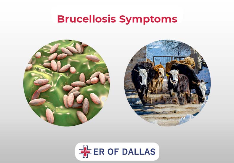 Brucellosis Symptoms - ER of Dallas