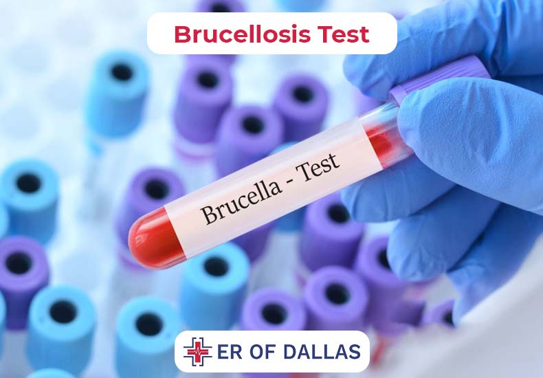 Brucellosis Test - ER of Dallas