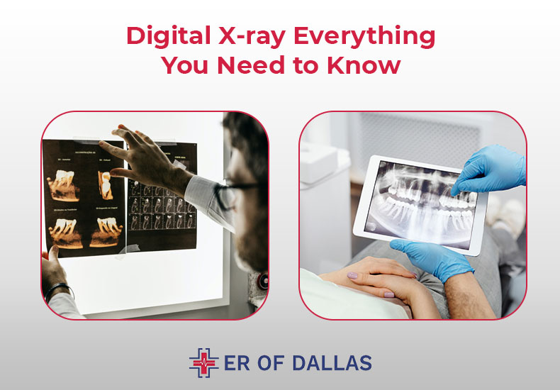 Digital X-ray - Evеrything You Nееd to Know - ER of Dallas