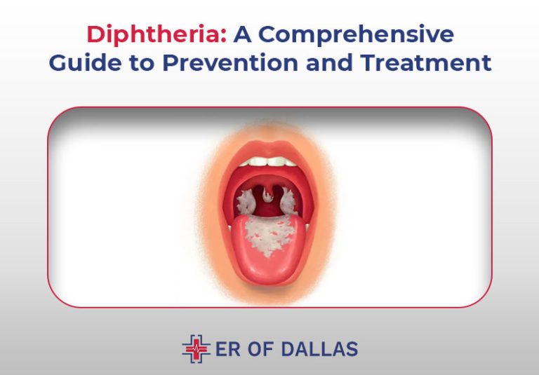 Diphtheria: A Comprehensive Guide to Prevention and Treatment - ER of ...