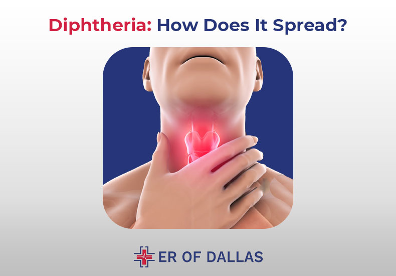 Diphtheria - How Does It Spread - ER of Dallas