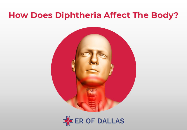 How Does Diphtheria Affect The Body - ER of Dallas