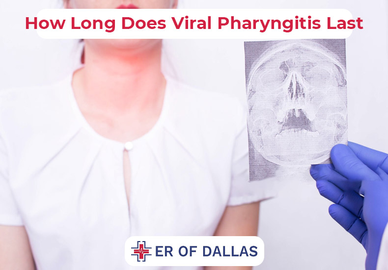 How Long Does Viral Pharyngitis Last - ER of Dallas