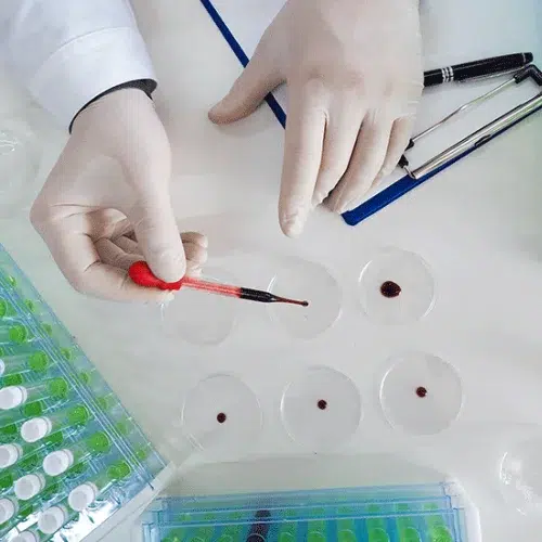 How-the-Results-of-the-Cardiac-Enzyme-Test-are-shown