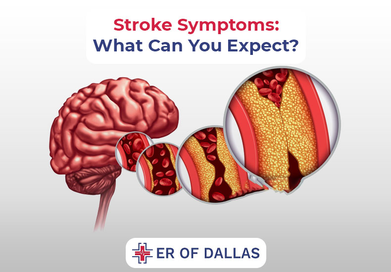 Stroke Symptoms - What Can You Expect - ER of Dallas