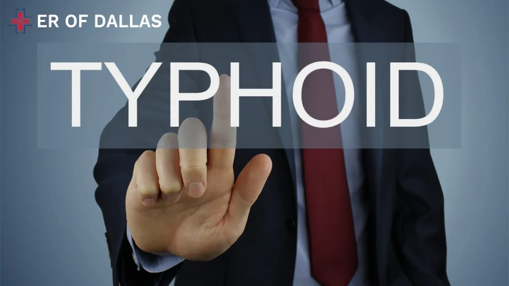 What Are The Phases of Typhoid - ER of Dallas