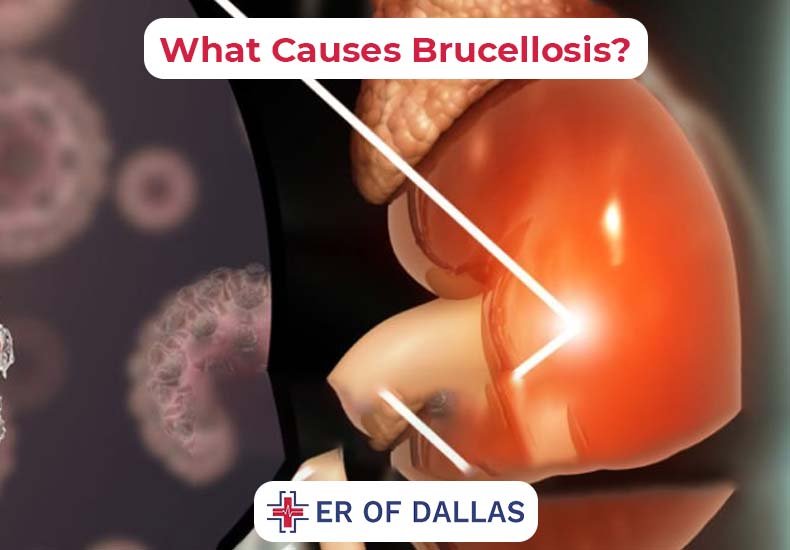 What Causes Brucellosis - ER of Dallas
