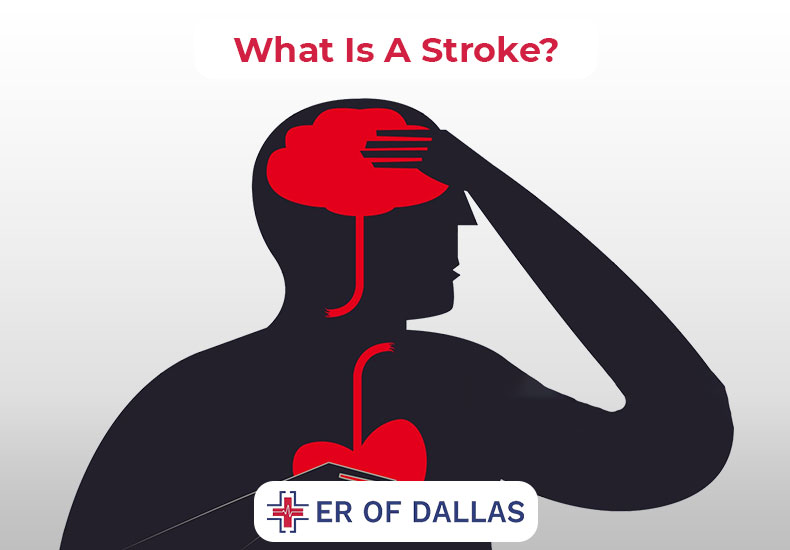 What Is A Stroke - ER of Dallas