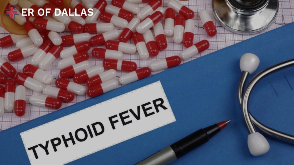 What You Need To Know About Typhoid Causes, Symptoms, Diagnoses, and Treatment - ER of Dallas