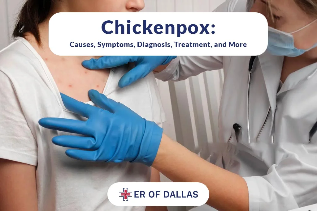Chickenpox - Causes, Symptoms, Diagnosis, Treatment and More - ER of Dallas