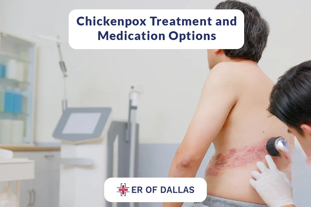 Chickenpox - Treatment and Medication Options - ER of Dallas