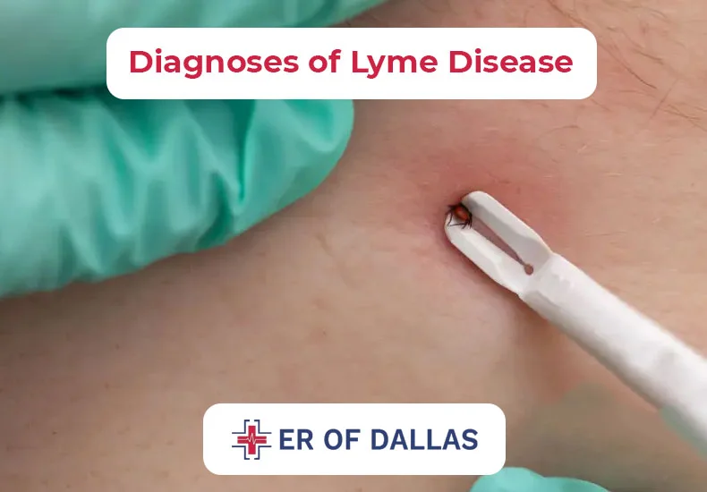 Diagnoses of Lyme Disease - ER of Dallas