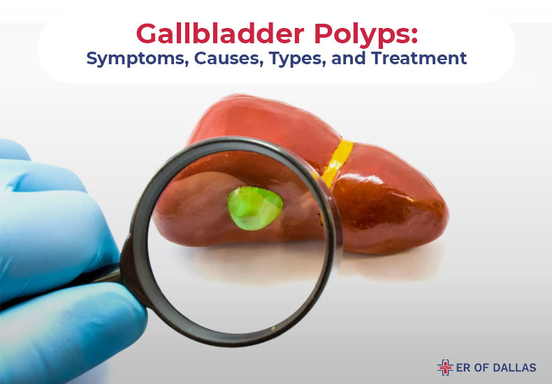 Gallbladder Polyps - Symptoms, Causes, Types and Treatment - ER of Dallas
