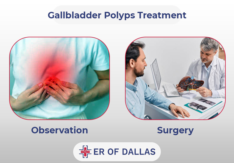 Gallbladder Polyps Treatment - ER of Dallas