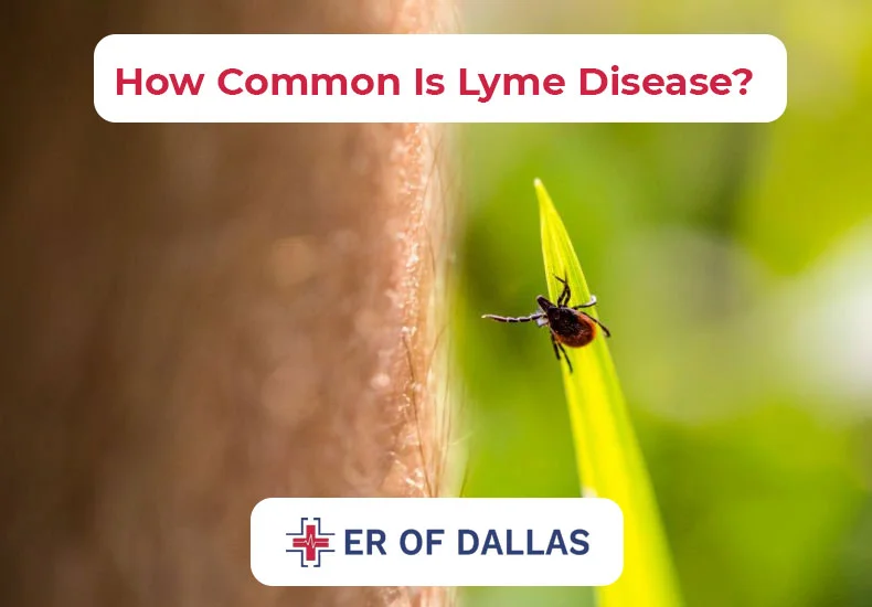 How Common Is Lyme Disease - ER of Dallas
