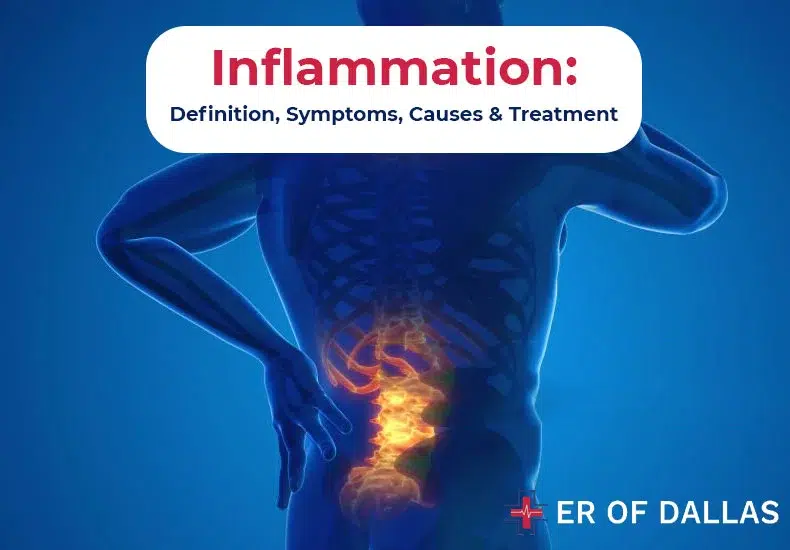 Inflammation - Definition, Symptoms, Causes and Treatment - ER of Dallas