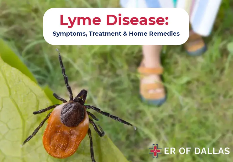 Lyme Disease - Symptoms, Treatment and Home Remedies - ER of Dallas