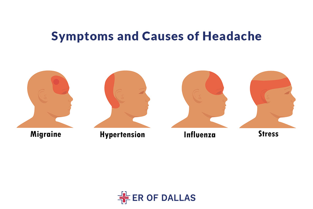Symptoms and Causes of Headache - ER of Dallas