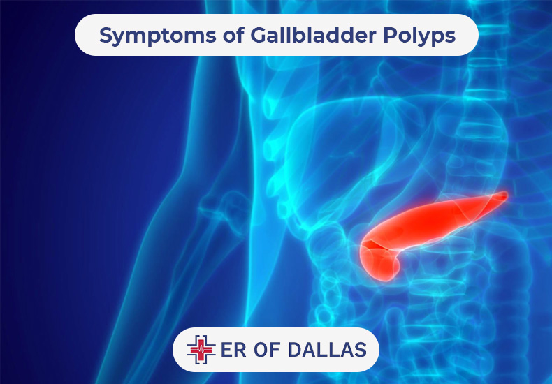 Symptoms of Gallbladder Polyps - ER of Dallas