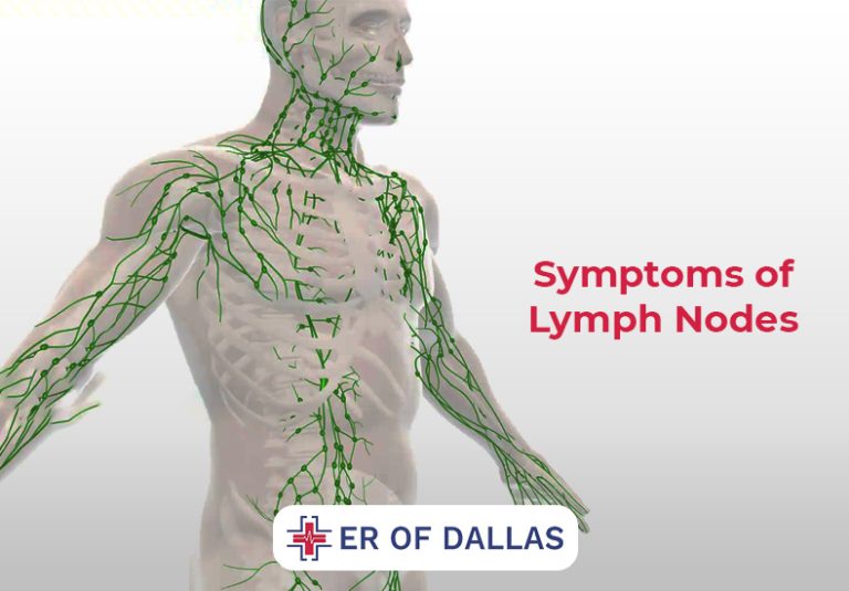 Lymph Nodes: Symptoms, Causes, Types, and More - ER of Dallas