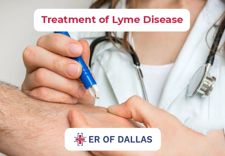 Treatment of Lyme Disease - ER of Dallas