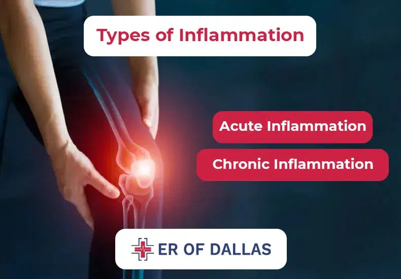 Types of Inflammation - ER of Dallas