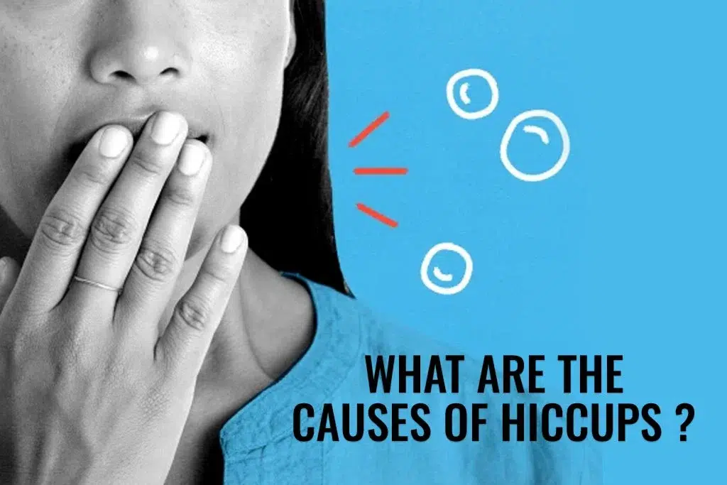 What Are The Causes of Hiccups - ER of Dallas