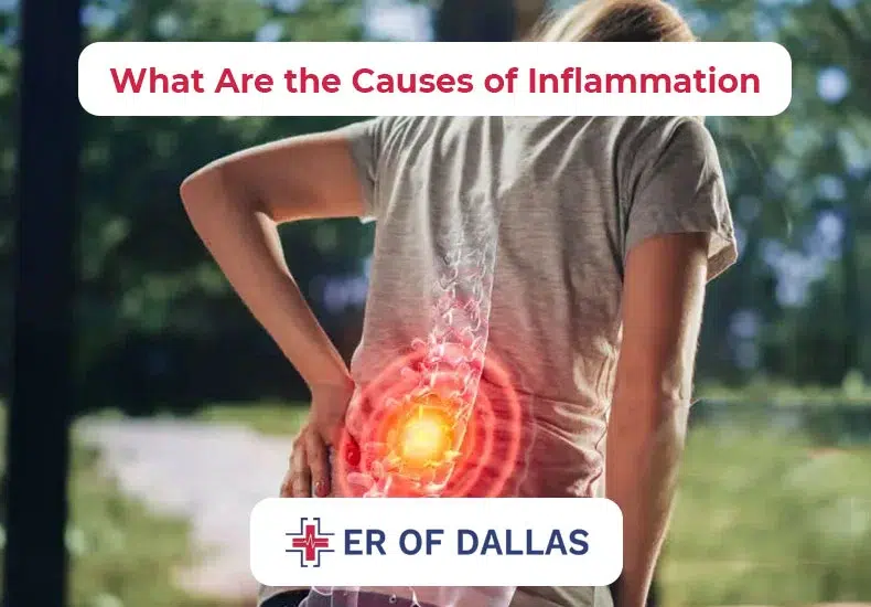 What Are the Causes of Inflammation - ER of Dallas