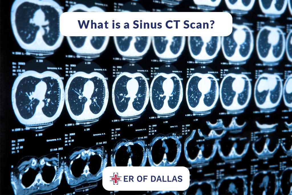 What is a Sinus CT Scan? - ER of Dallas