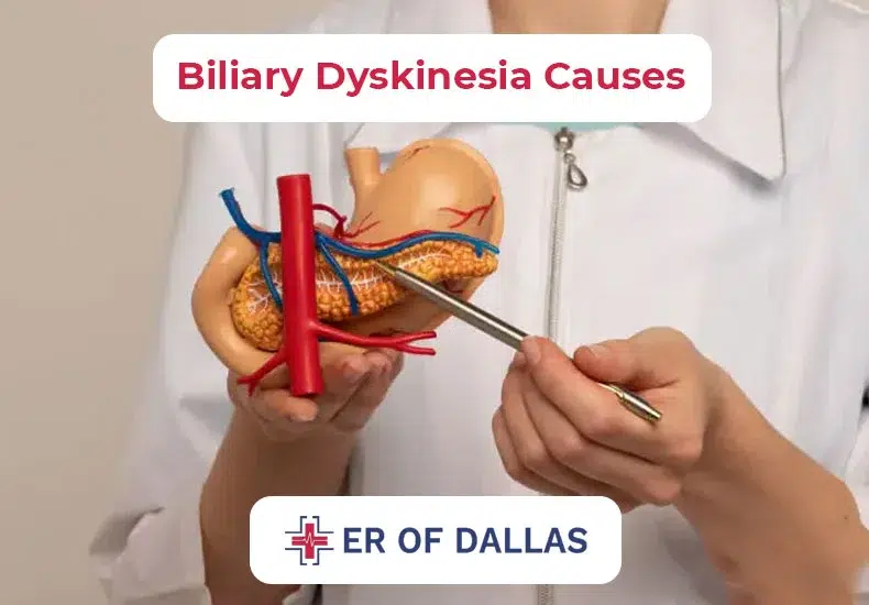 Biliary Dyskinesia Causes - ER of Dallas