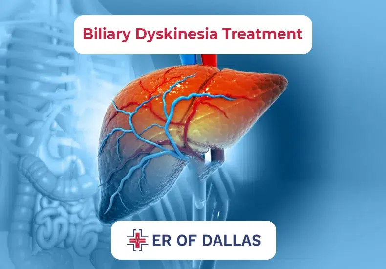 Biliary Dyskinesia Treatment - ER of Dallas