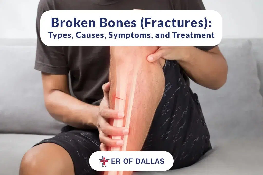Broken Bones - Fractures, Types, Causes, Symptoms and Treatment - ER of Dallas