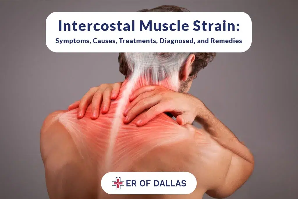 Intercostal Muscle Strain - Symptoms, Causes, Treatments, Diagnosed and Remedies - ER of Dallas
