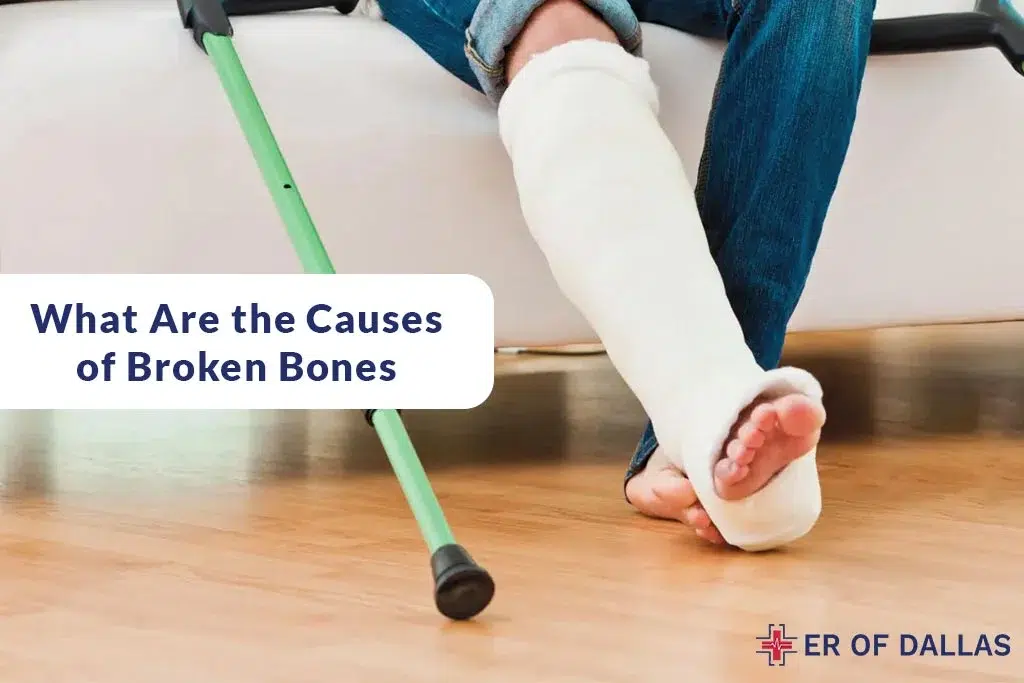 What Are The Causes of Broken Bones - ER of Dallas