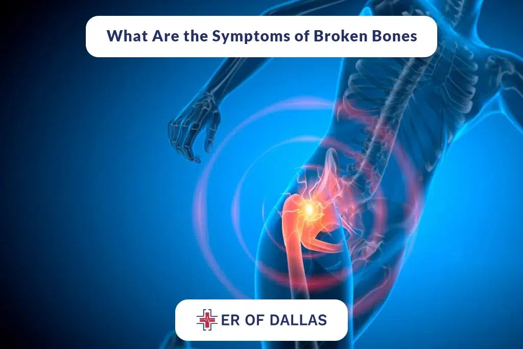 What Are The Symptoms of Broken Bones - ER of Dallas