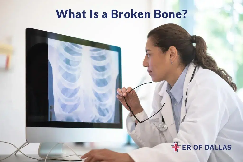 What Is A Broken Bone - ER of Dallas