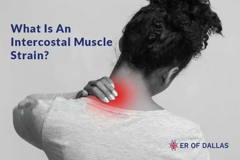 What Is An Intercostal Muscle Strain - ER of Dallas
