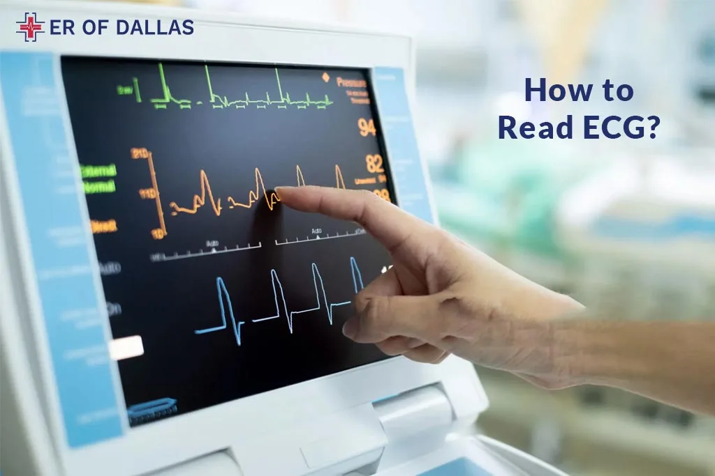 How to Read ECG - ER of Dallas
