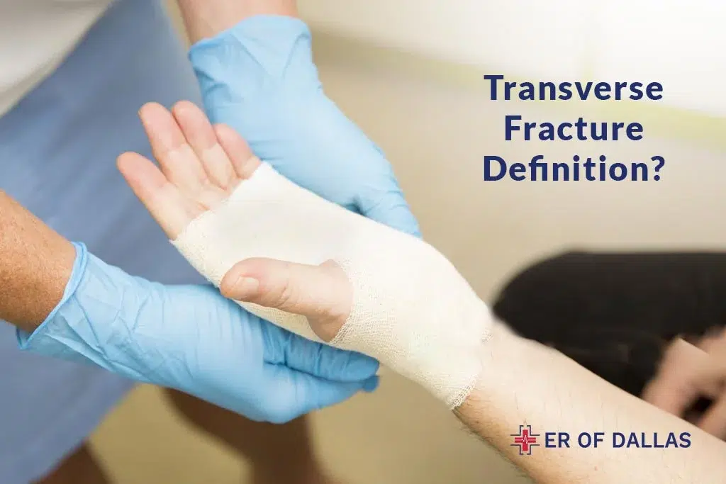 Transverse Fracture Definition - ER of Dallas