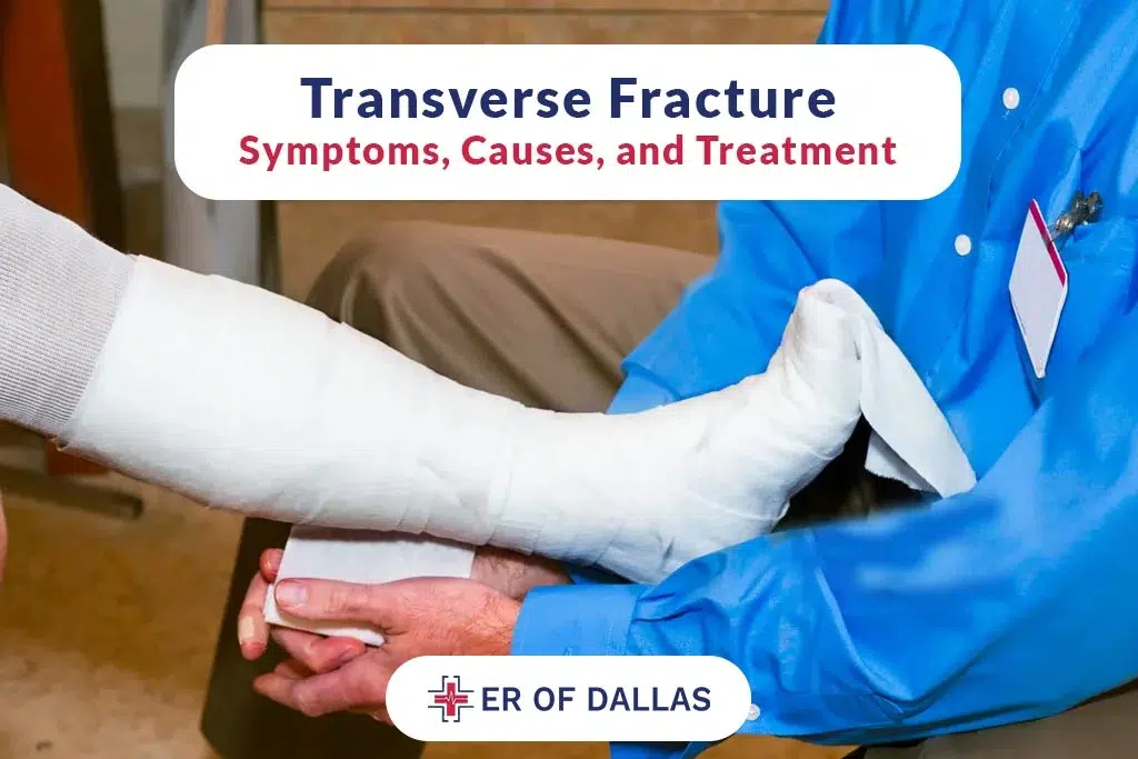 Transverse Fracture - Symptoms Causes and Treatment - ER of Dallas