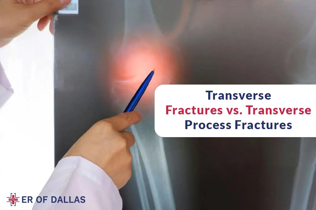 Transverse Fractures vs Transverse Process Fractures - ER of Dallas