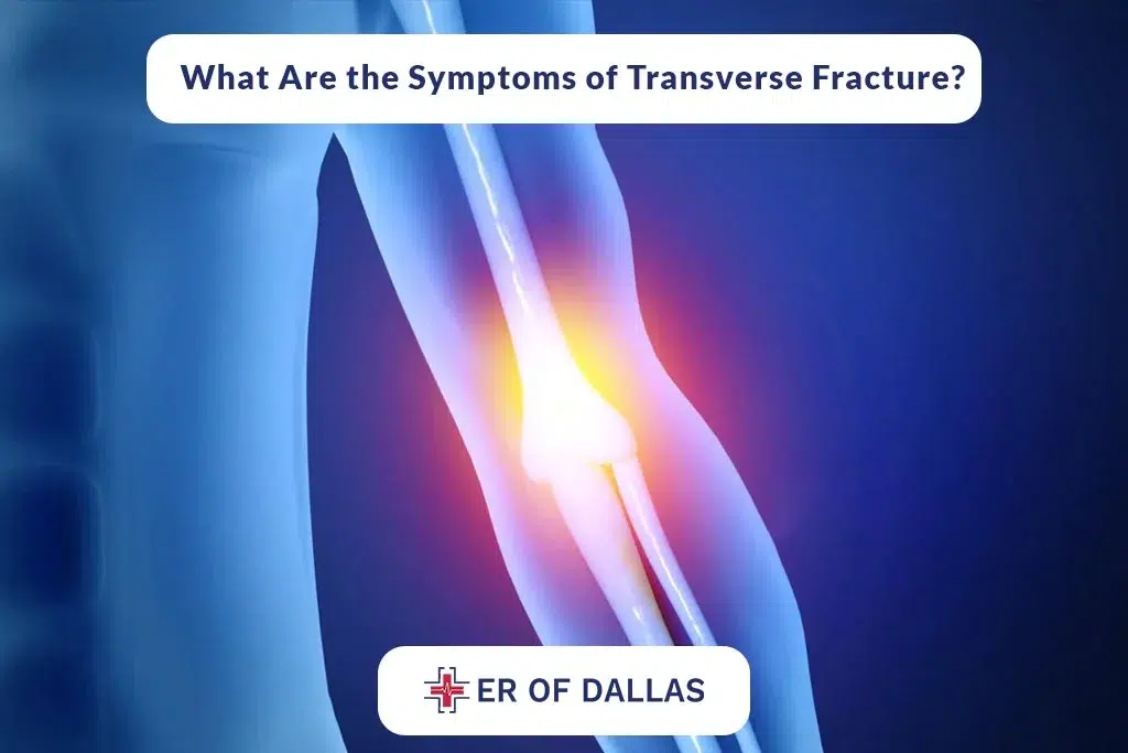 What Are The Symptoms of Transverse Fracture - ER of Dallas
