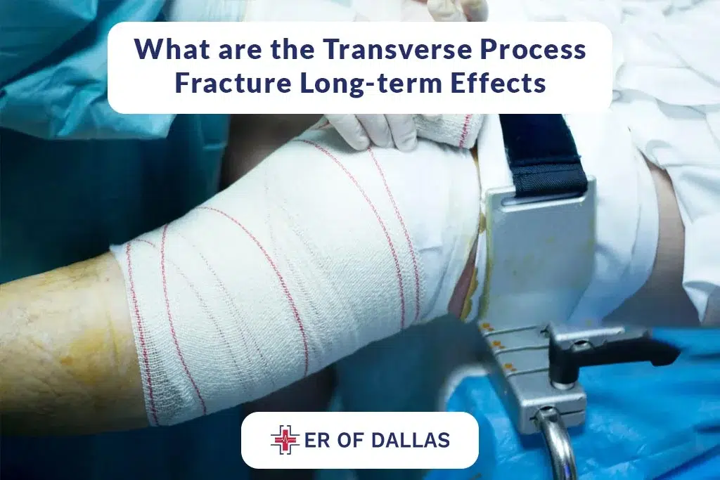 What are the Transverse Process Fracture Long Term Effects - ER of Dallas