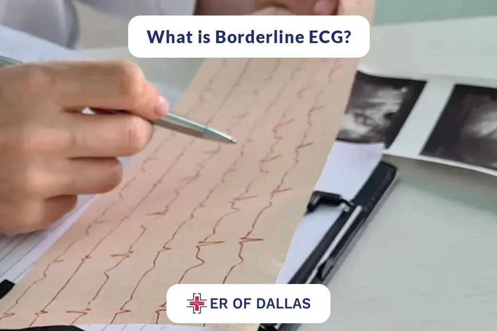 What is Borderline ECG - ER of Dallas