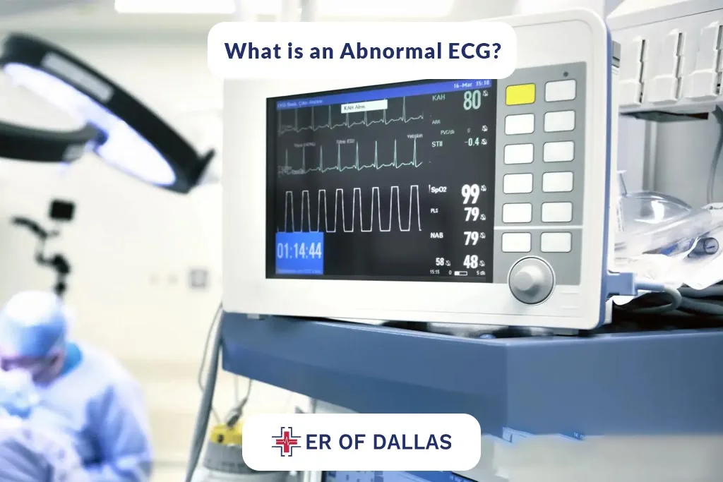 What is an Abnormal ECG - ER of Dallas