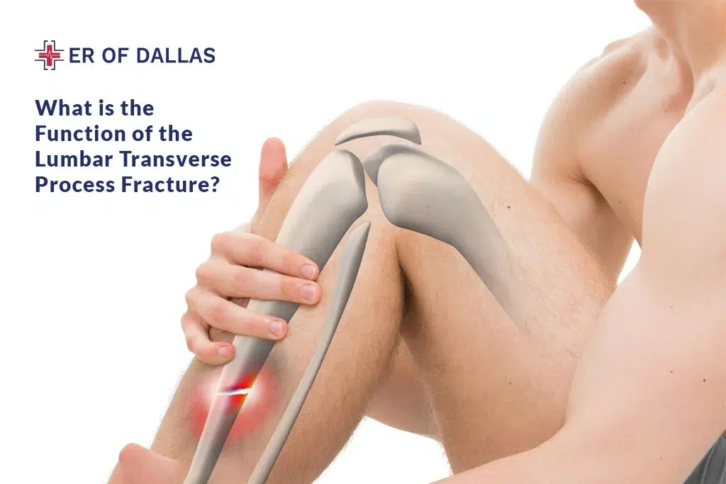 What is the Function of the Lumbar Transverse Process Fracture - ER of Dallas