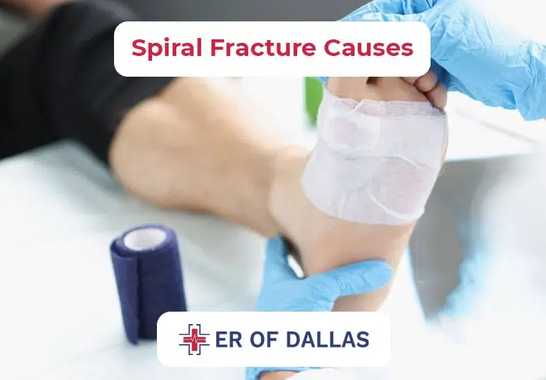 Spiral Fracture Causes - ER of Dallas